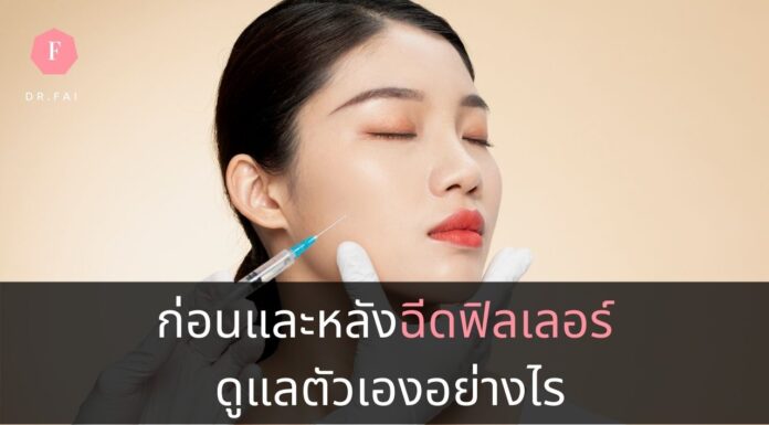 การดูแลตัวเองก่อนและหลังฉีดฟิลเลอร์