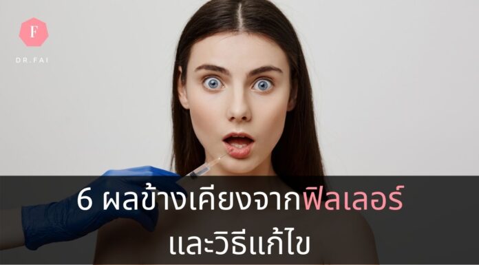 ผลข้างเคียงจากการฉีดฟิลเลอร์