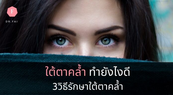 วิธีรักษาใต้ตาคล้ำ