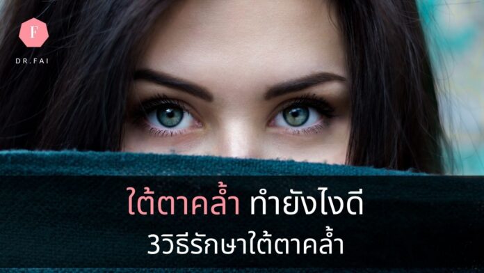 วิธีรักษาใต้ตาคล้ำ