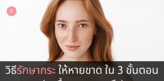 วิธีรักษากระ