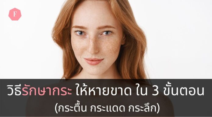 วิธีรักษากระ