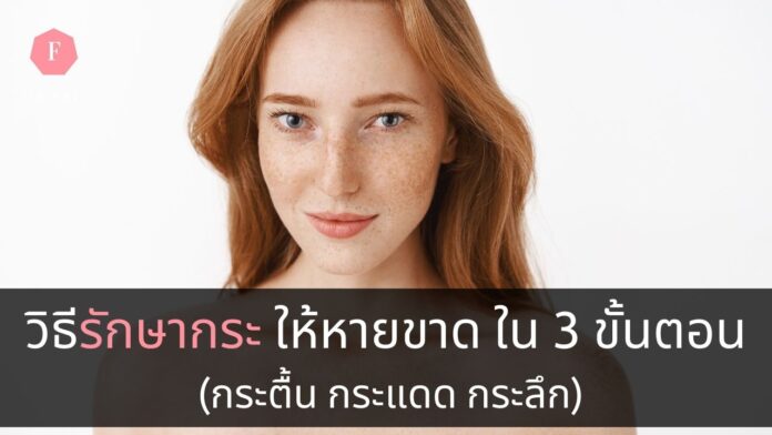 วิธีรักษากระ