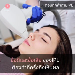 ข้อดีข้อเสียIPL