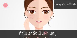 4สาเหตุการเกิดฝ้า