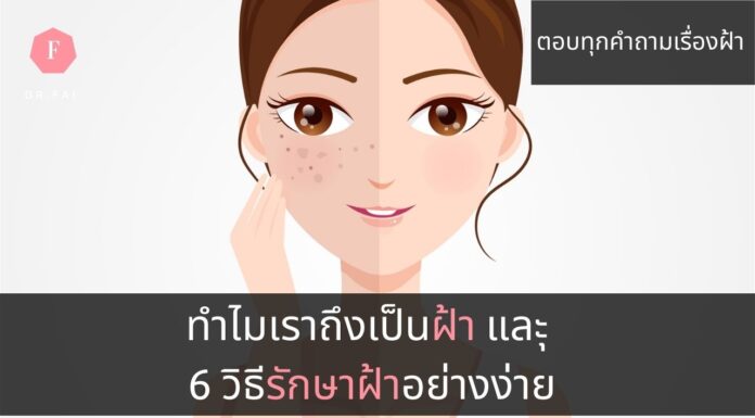 4สาเหตุการเกิดฝ้า