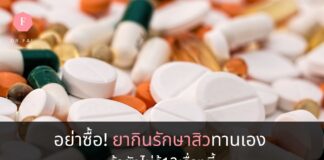 ยากินรักษาสิว