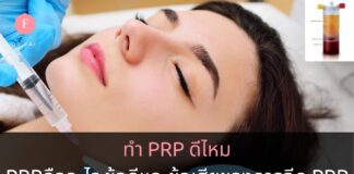 การฉีดPRP
