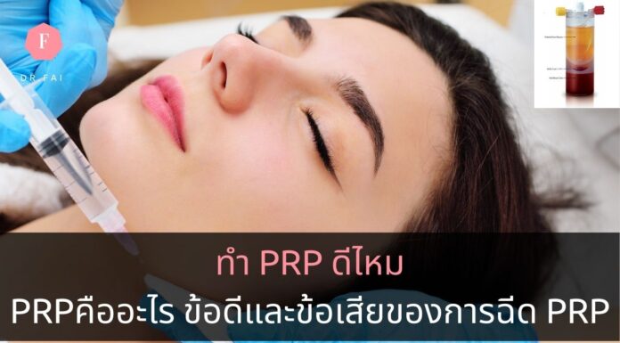 ทำ PRP ดีไหม PRPคืออะไร ข้อดีข้อเสียของการฉีดPRP การฉีดPRP