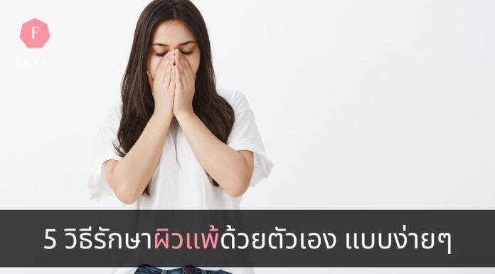 5 วิธีรักษาผิวแพ้ด้วยตัวเอง แบบง่ายๆ รักษาอาการผิวแพ้ง่าย