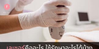 เลเซอร์คืออะไร