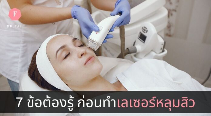 7 ข้อต้องรู้ ก่อนทำเลเซอร์หลุมสิว เลเซอร์หลุมสิว