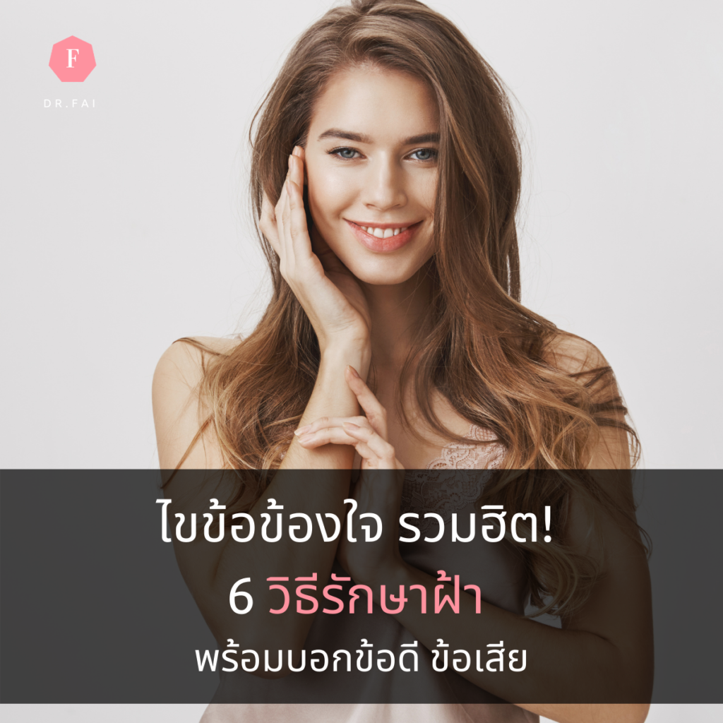 6วิธีรักษาฝ้า