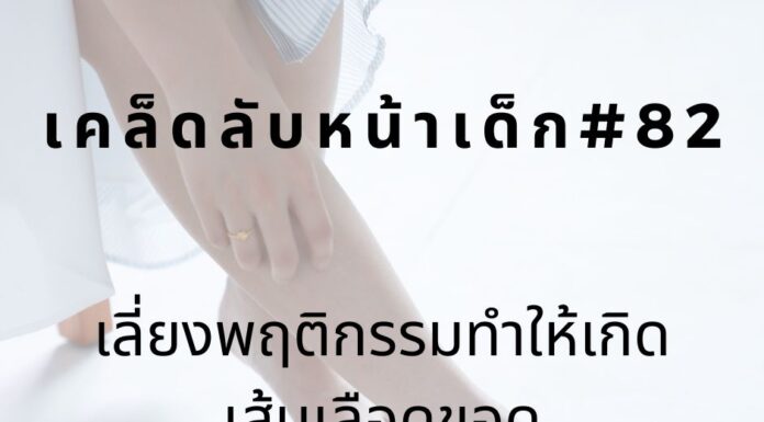 เคล็ดลับหน้าเด็ก#82 เลี่ยงพฤติกรรมทำให้เกิดเส้นเลือดขอด หน้าเด็ก ลดเส้นเลือดขอด