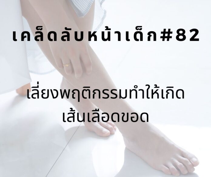 หน้าเด็ก82 หน้าเด็ก ลดเส้นเลือดขอด