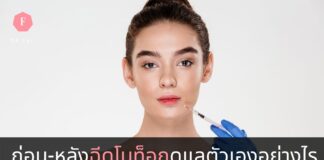 ก่อนและหลังฉีดโบท็อก
